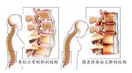 南京强脊诊疗中心